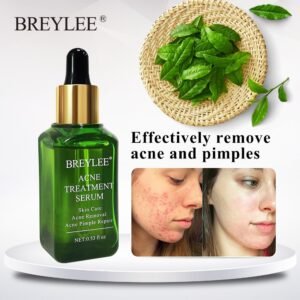 Crème Anti-Acné BREYLEE – Soin Réparateur & Éclaircissant